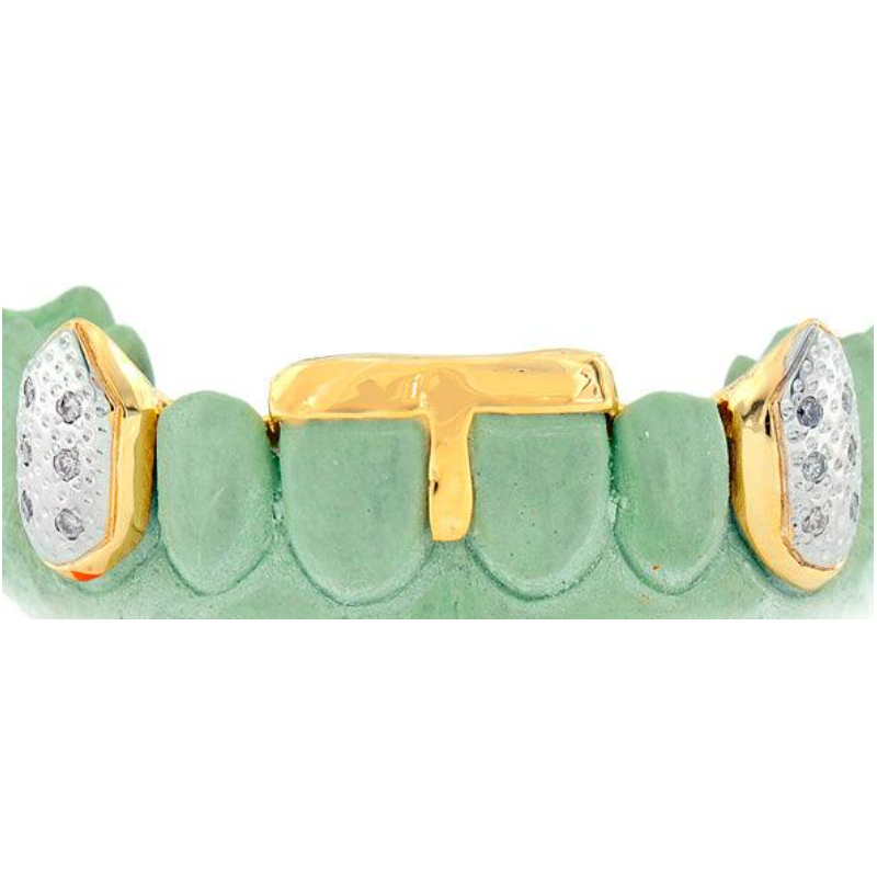 Custom Gold &amp; Diamond caps with backbar and gap