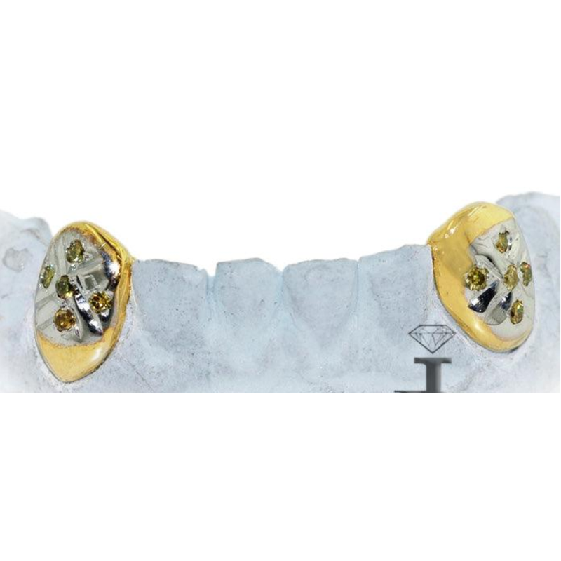 2 Teeth Gold fangs with Diamonds