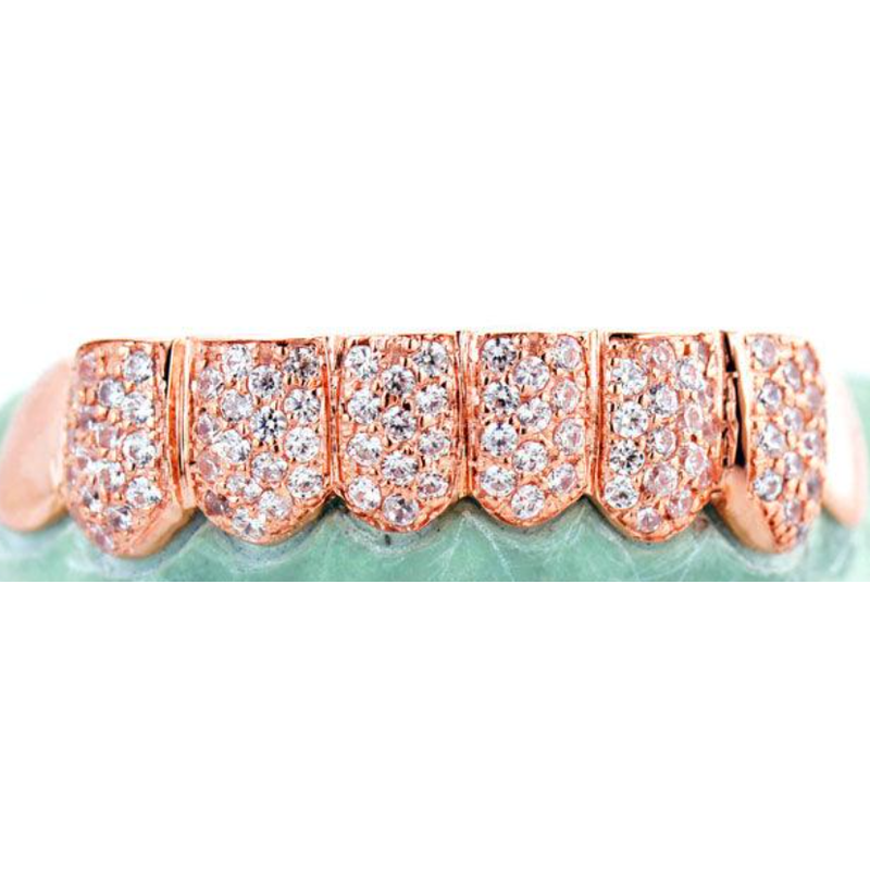 Rose Gold Prong Set Grillz