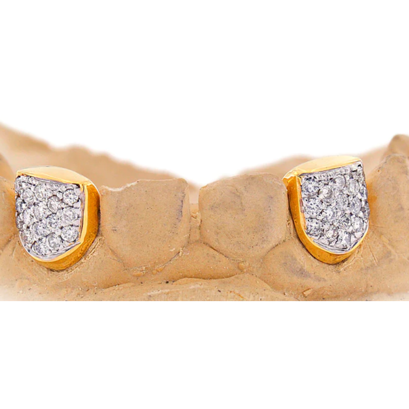 2 hand prong set diamond teeth