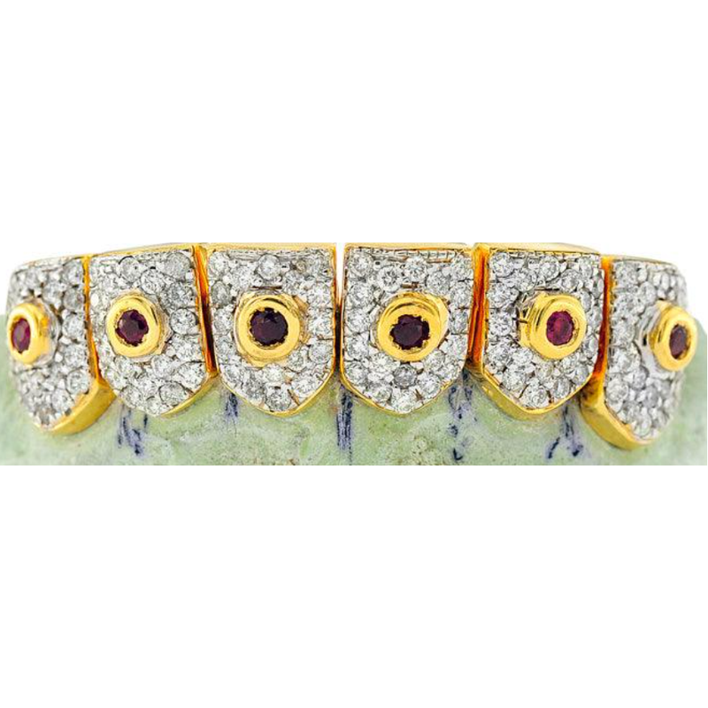 18k, Diamond and Ruby individual teeth