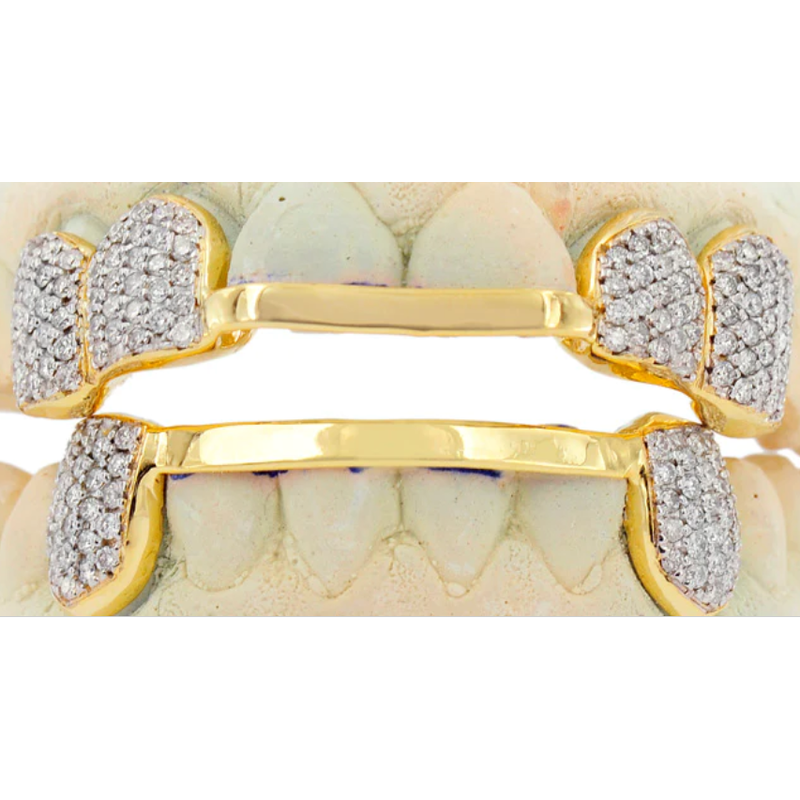 Hand Prong Set Diamond grill with solid cross bar