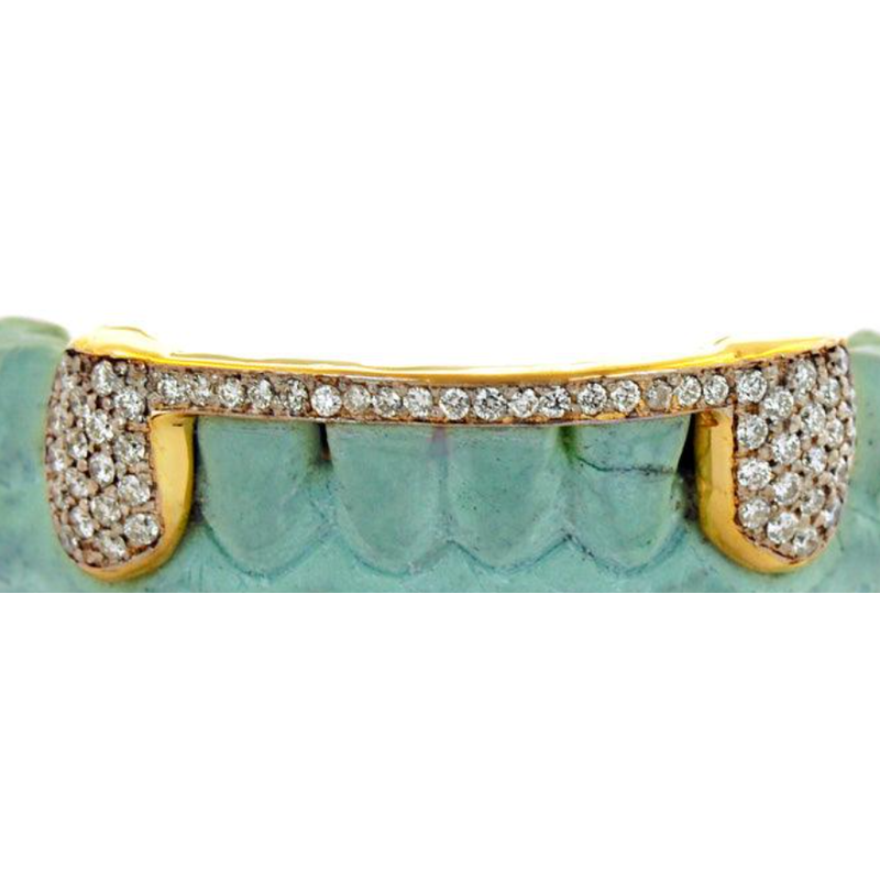 Custom Bar 2 Teeth Diamond Grill