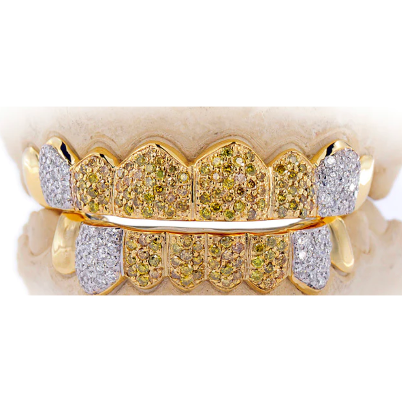 Canary &amp; Diamond Grillz