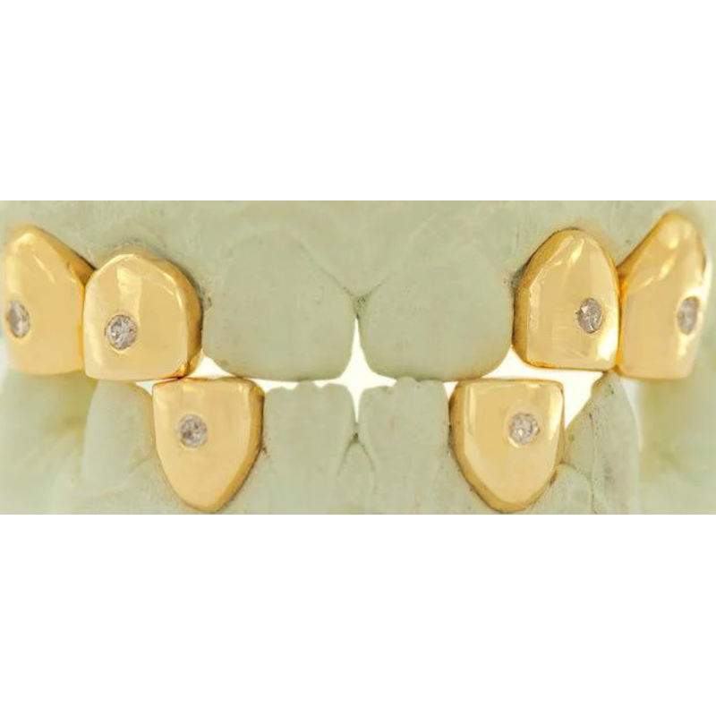 Pave Set Single Diamond Grill