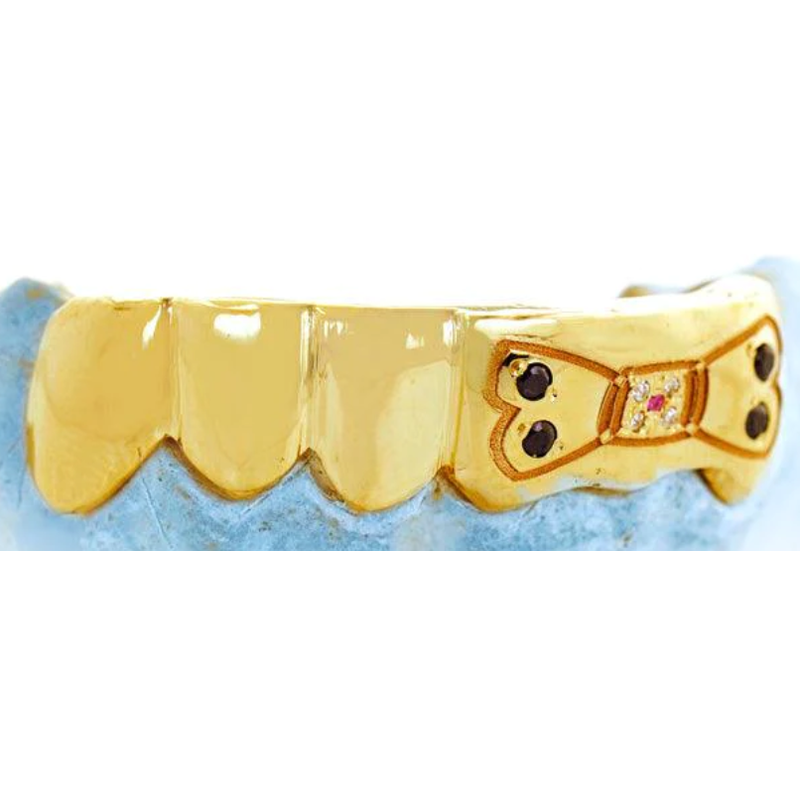 yellow gold grill with engraved bow