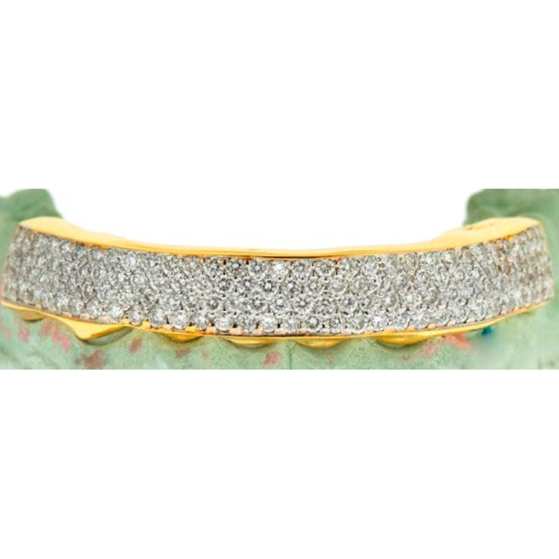 8 piece hand prong set Diamond grill