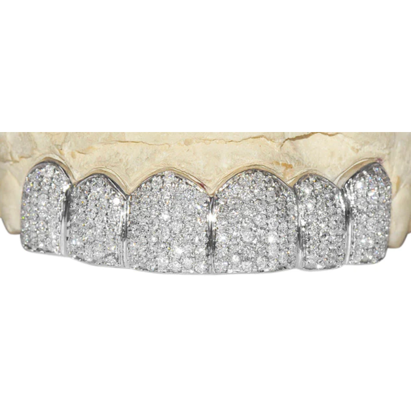 Micro Diamond, Hand Prong Set Grill