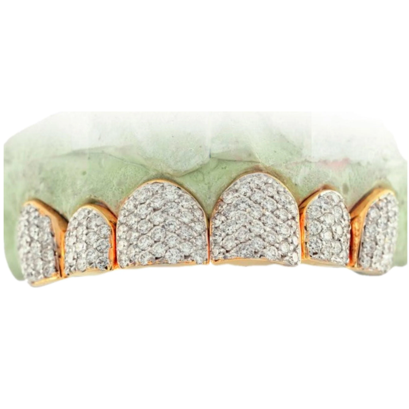 6 Teeth, hand prong set Diamond individuals