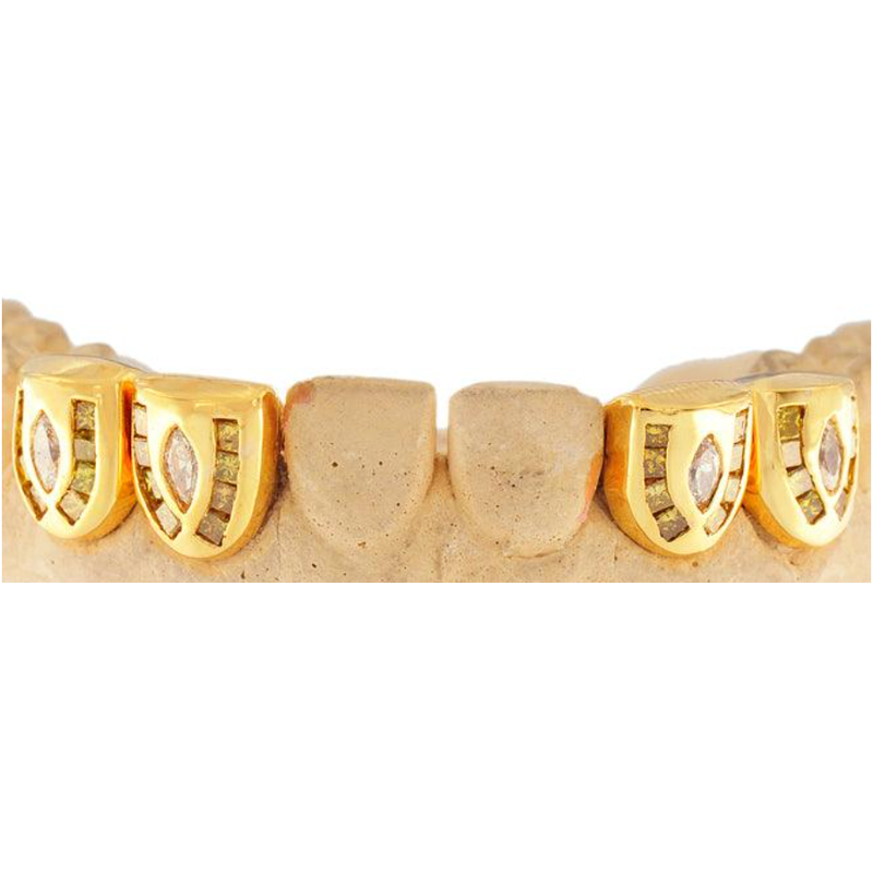 individual channel set diamond grill
